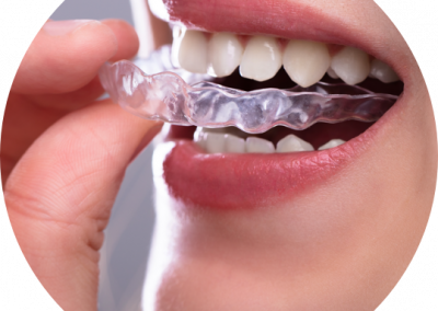 Endodonzia e odontoiatria conservativa